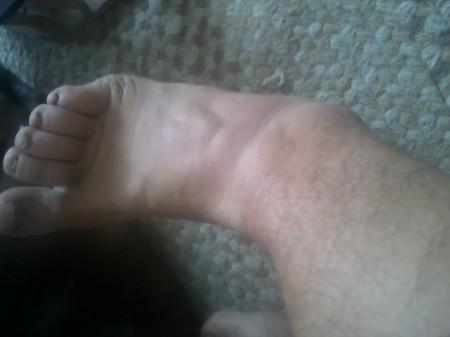 That's my ankle. Seriously.